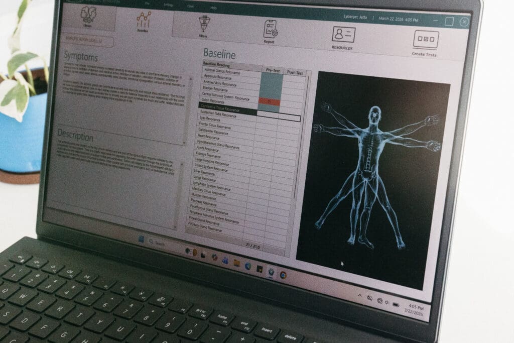 Bio-resonance scan in progress 