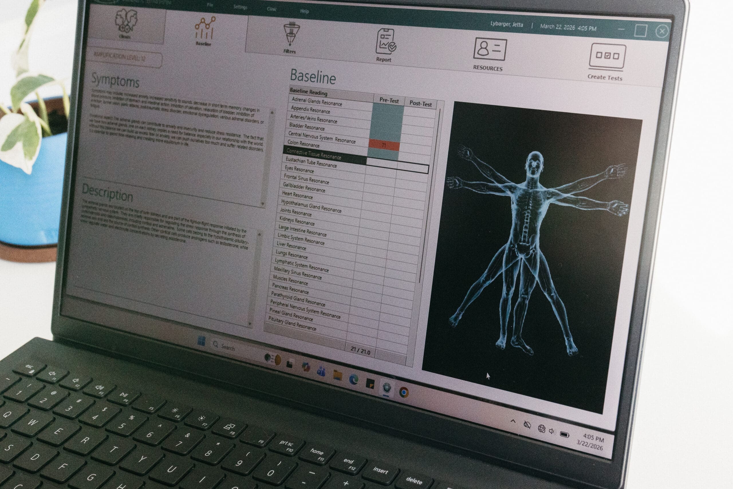 Bio-resonance scan in progress
